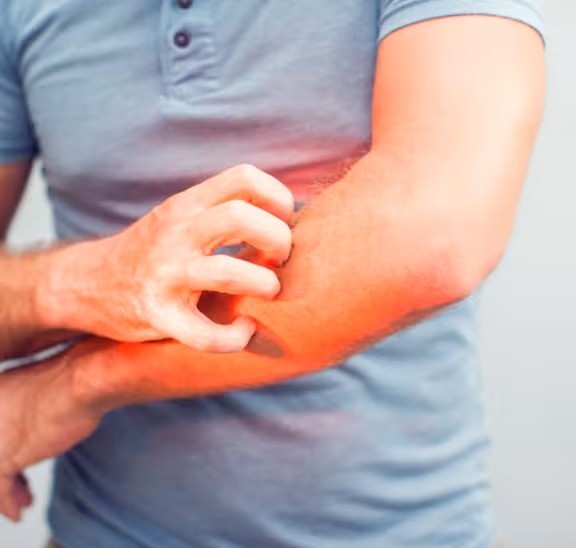 Laser Tattoo Removal