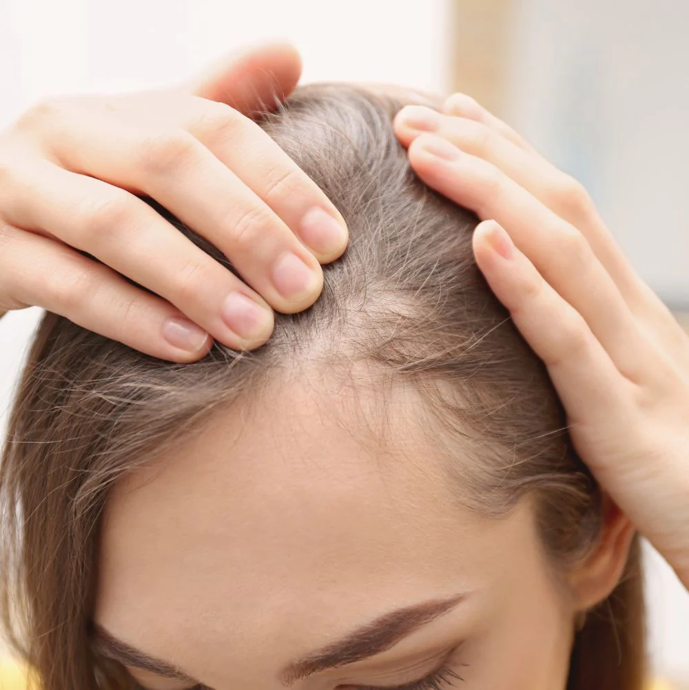 Hair Loss Treatment